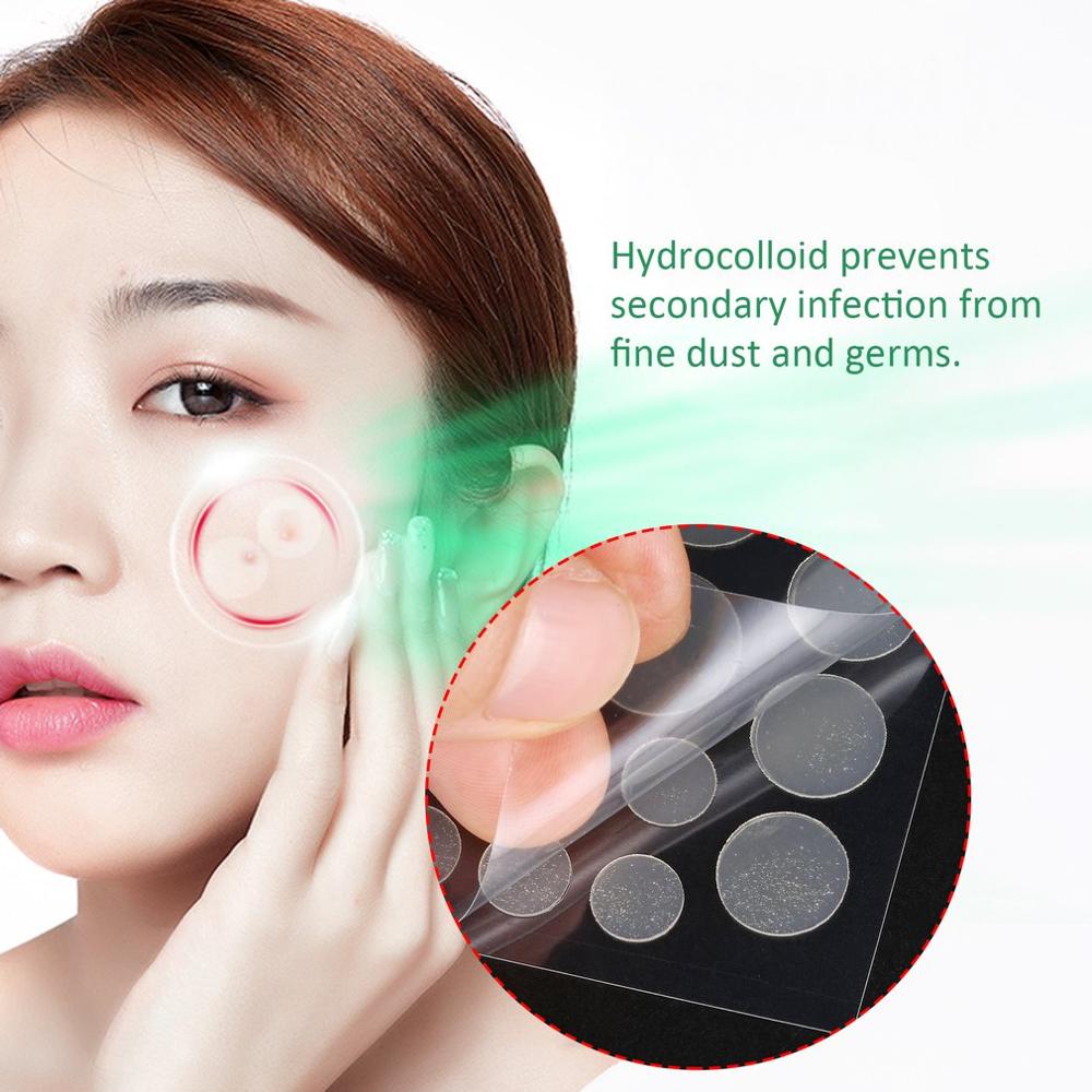 Pimple Remover Stickers