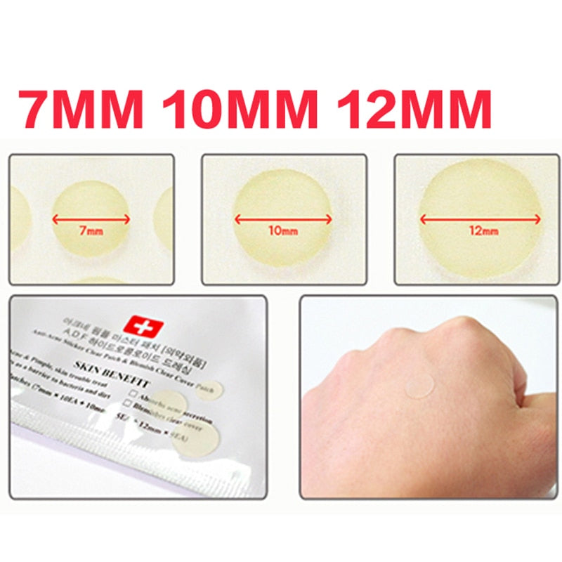 Pimple Remover Stickers